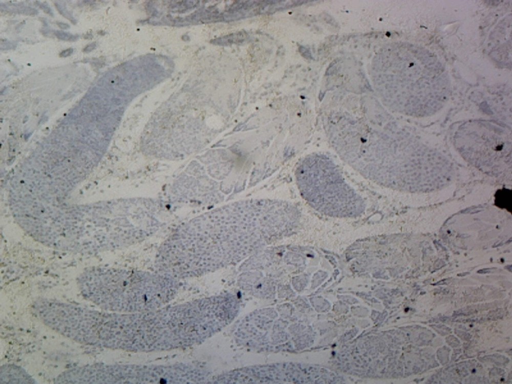 Grasshopper Testis; Whole-mount; IH Stain