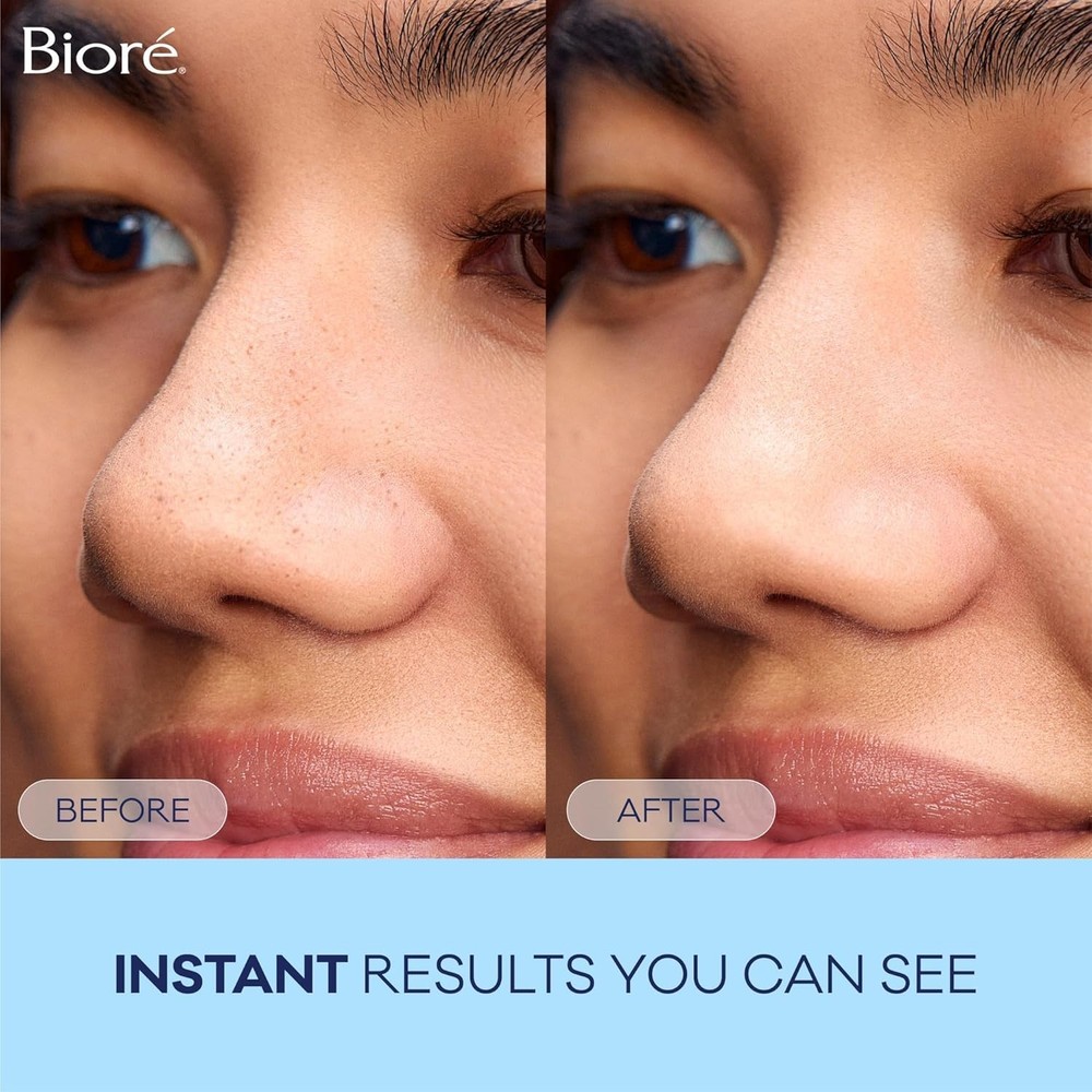 C-Bond Technology Blackhead Removing Strips - Instant Pore Cleansing, 14 Count