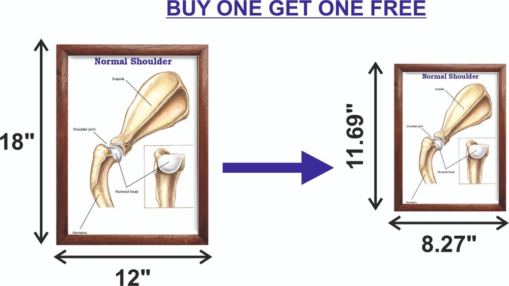 Normal Shoulder Chart 12x18 inches