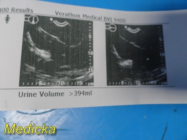 Verathon BVI9400 Ref 0570-0190 Bladder Scanner Console ONLY ~ 38394