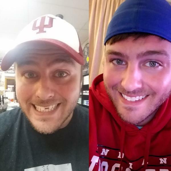 Temptooth Kit Original Temp tooth Missing Tooth Replacement Over 250,000 Sold