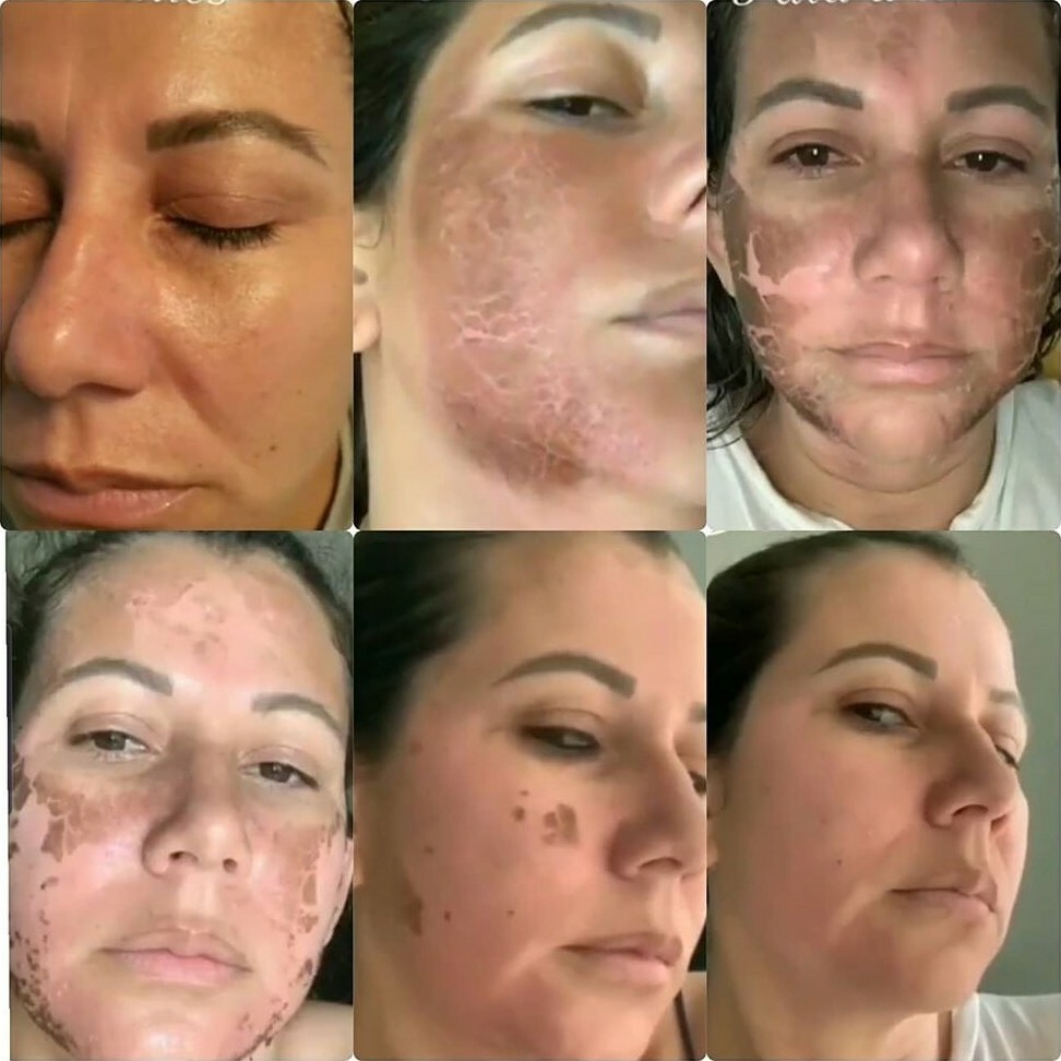 MONNASKIN Algae Pell (peeling De Algas )