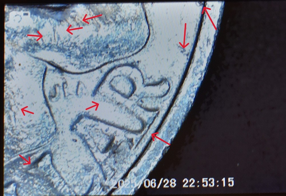 Bicentennial Quarter Error Stike Through with Die Cracks, Chips Closed AM+
