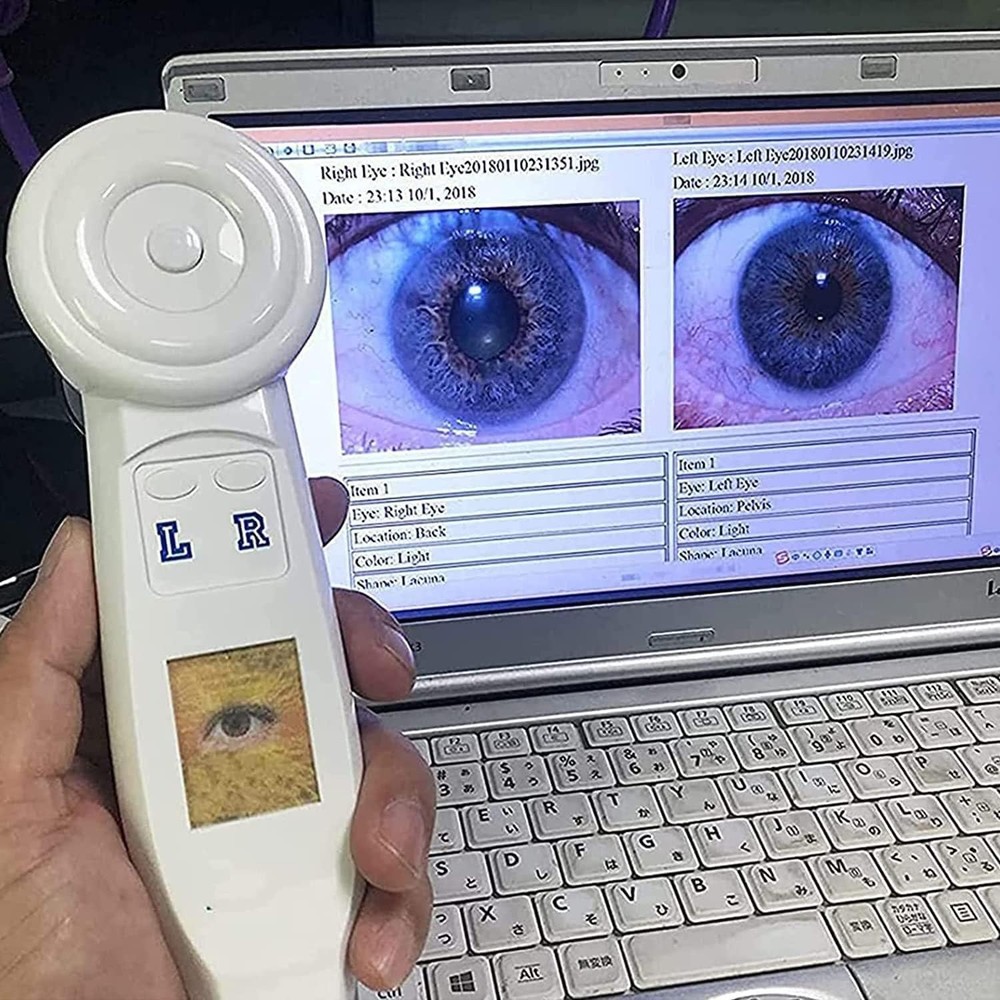 5.0MP USB Iris Analyzer Iridology Camera, 30x Iris Analysis Camera Analyzer Tool