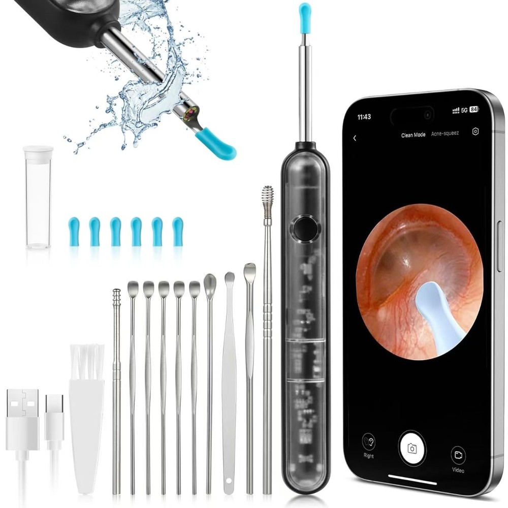 FoxSync 5MP 2560x1920 HD Ear Wax Removal Tool with Camera – Includes...