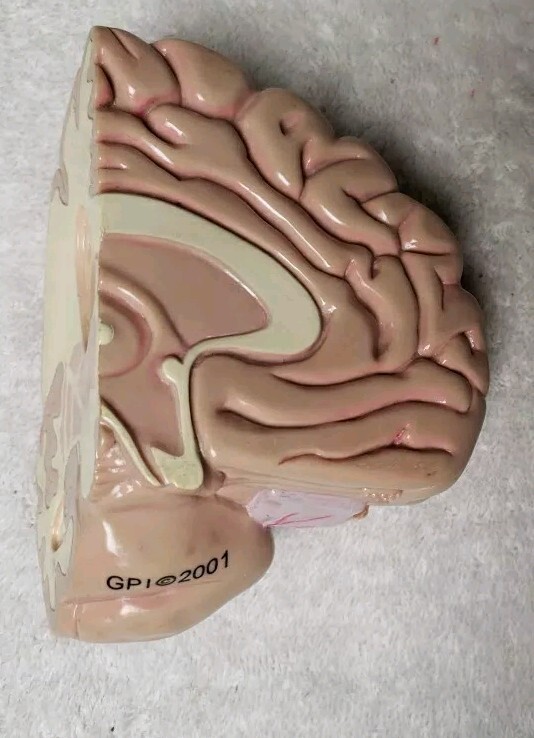 GPI Brain/ Partial Skull Model
