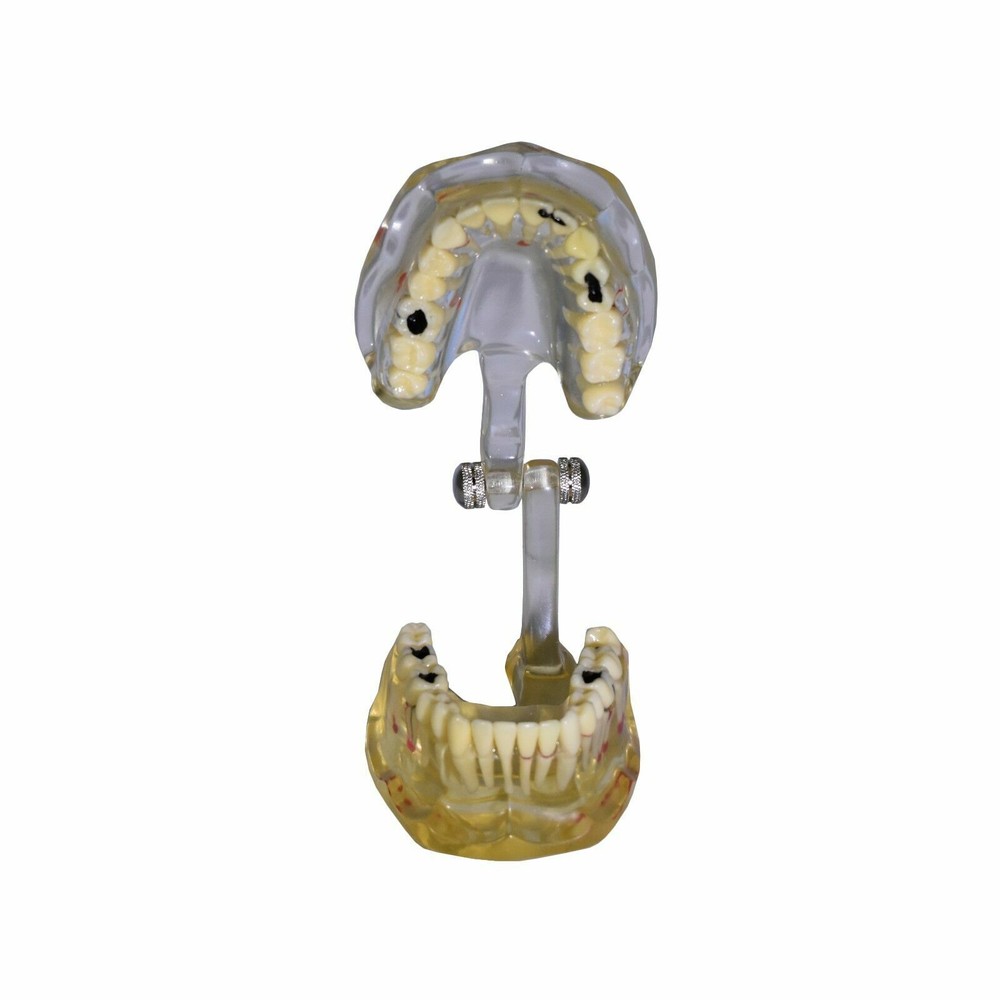 REDLAND 1331 Model Dental Demonstration Teeth Educational Model