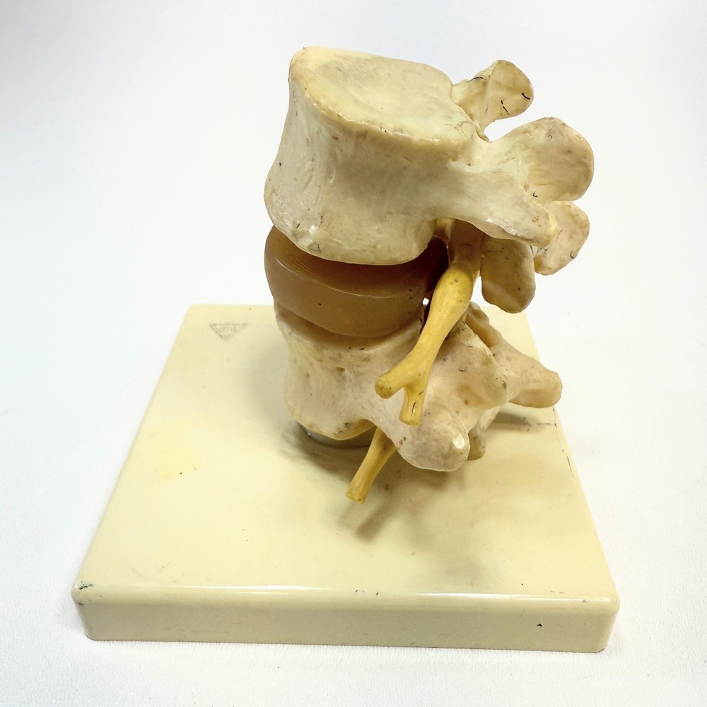 Lumber Vertibrae Model with Disc on Stand
