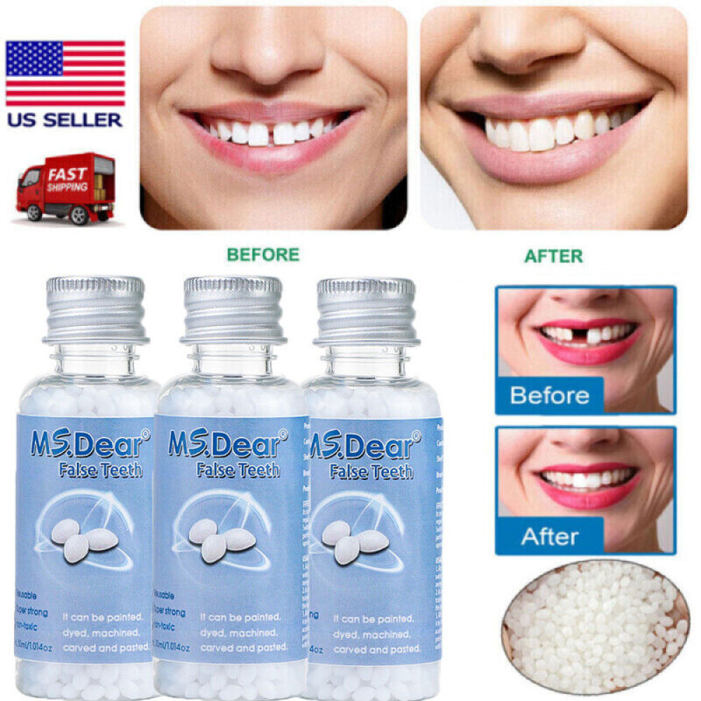 3PCS Tooth Repair Granules Temporary Fitting Beads Reusable Moldable False Teeth