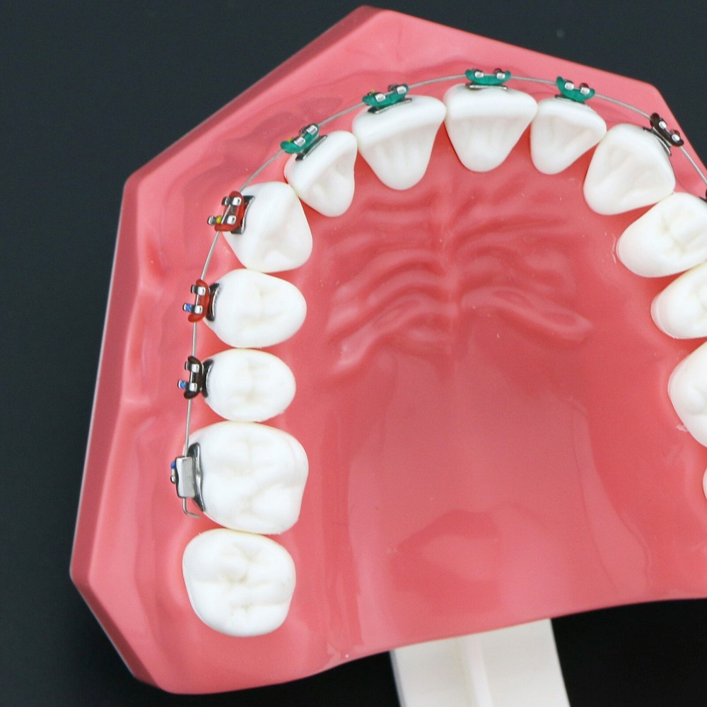 US Dental Typodont Teeth Model with Orthodontic Brackets Brushing