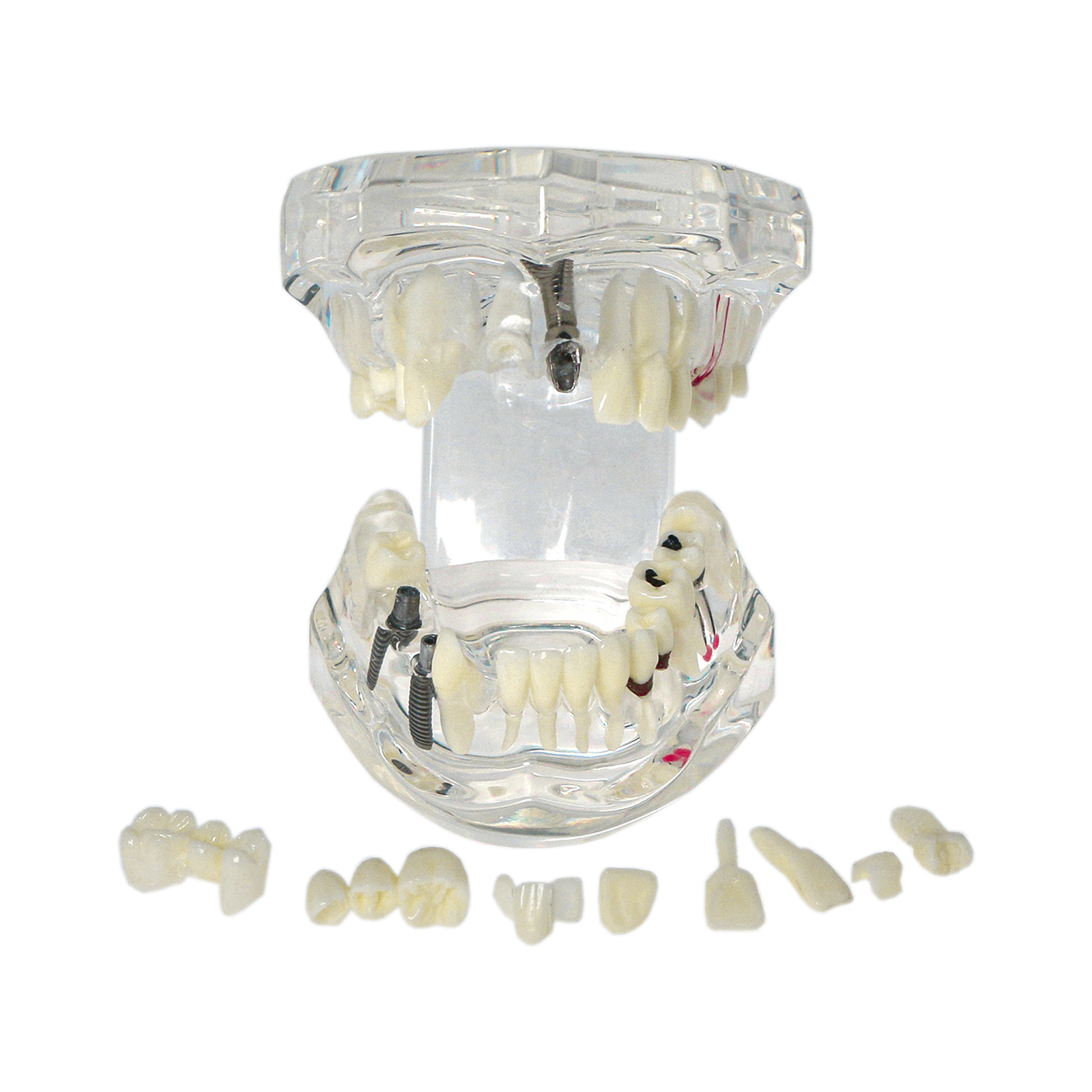 Dental Oral Typodont Model Implant Pathological Teaching Standard Size (Clear)