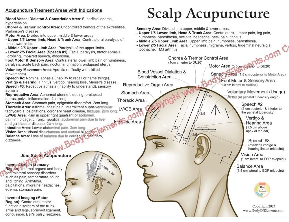 Scalp Acupuncture Points Chart 8.5" X 11" Head Microsystem