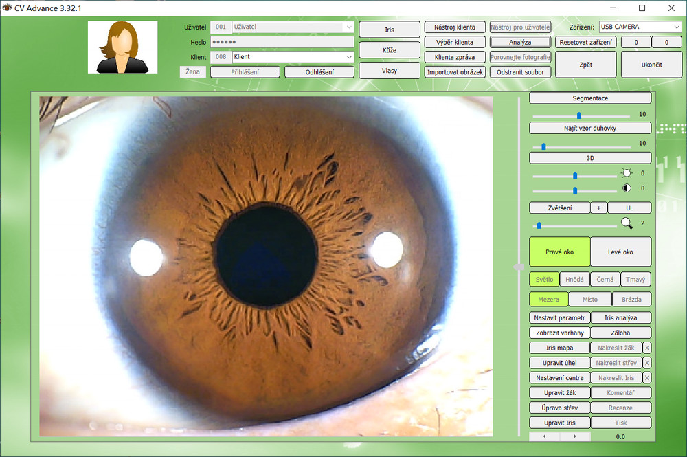 Analyzer Camera HD Iriscope Eye Camera with English Analysis Software for Eye US