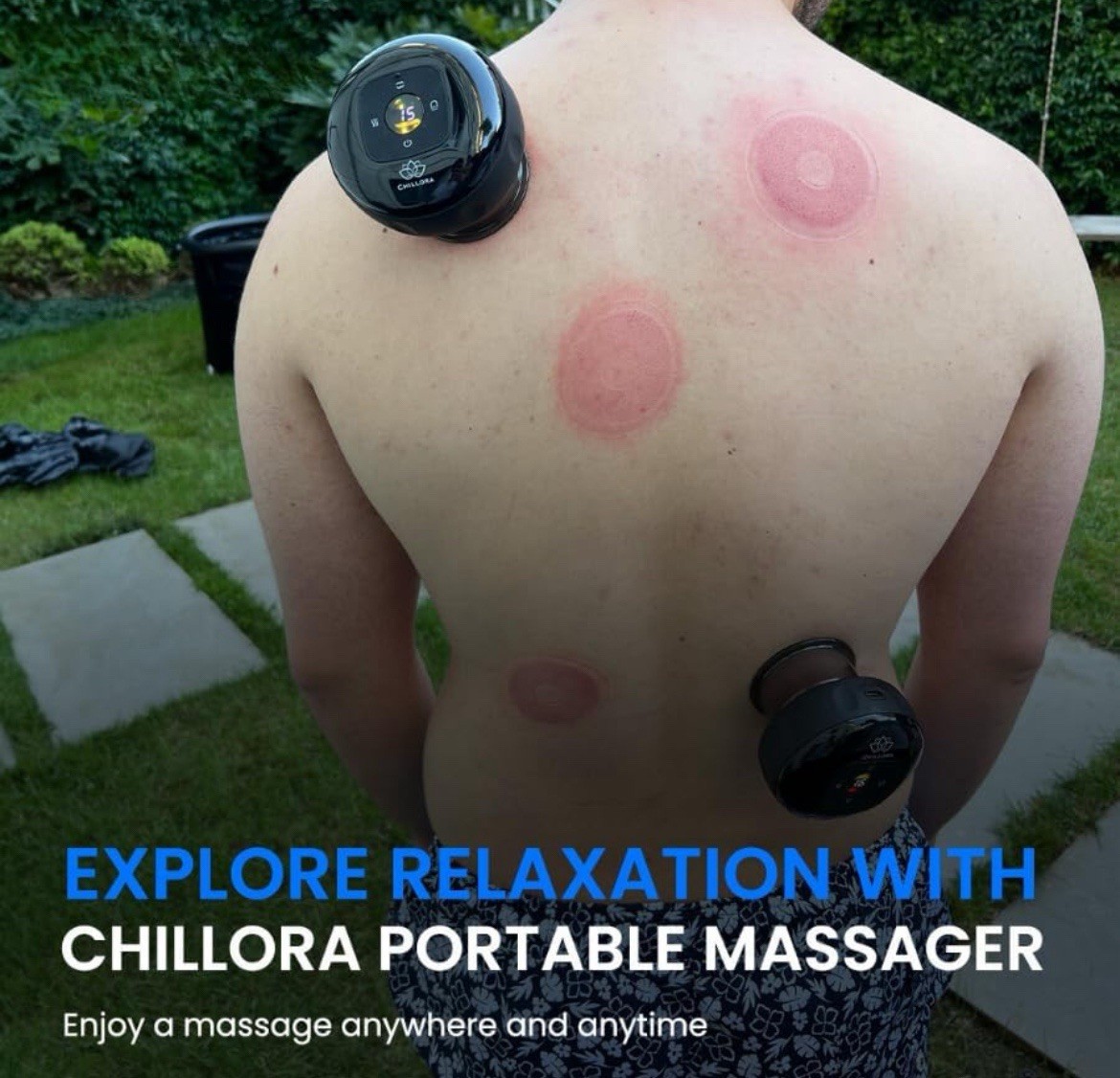 2pcs 5-in-1 Electric Cupping Therapy Set, Cupping Therapy Massager, 15levels