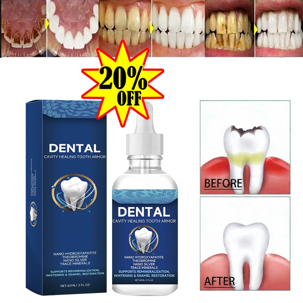60ml Tooth care solution Cavity Healing Tooth Armor USA