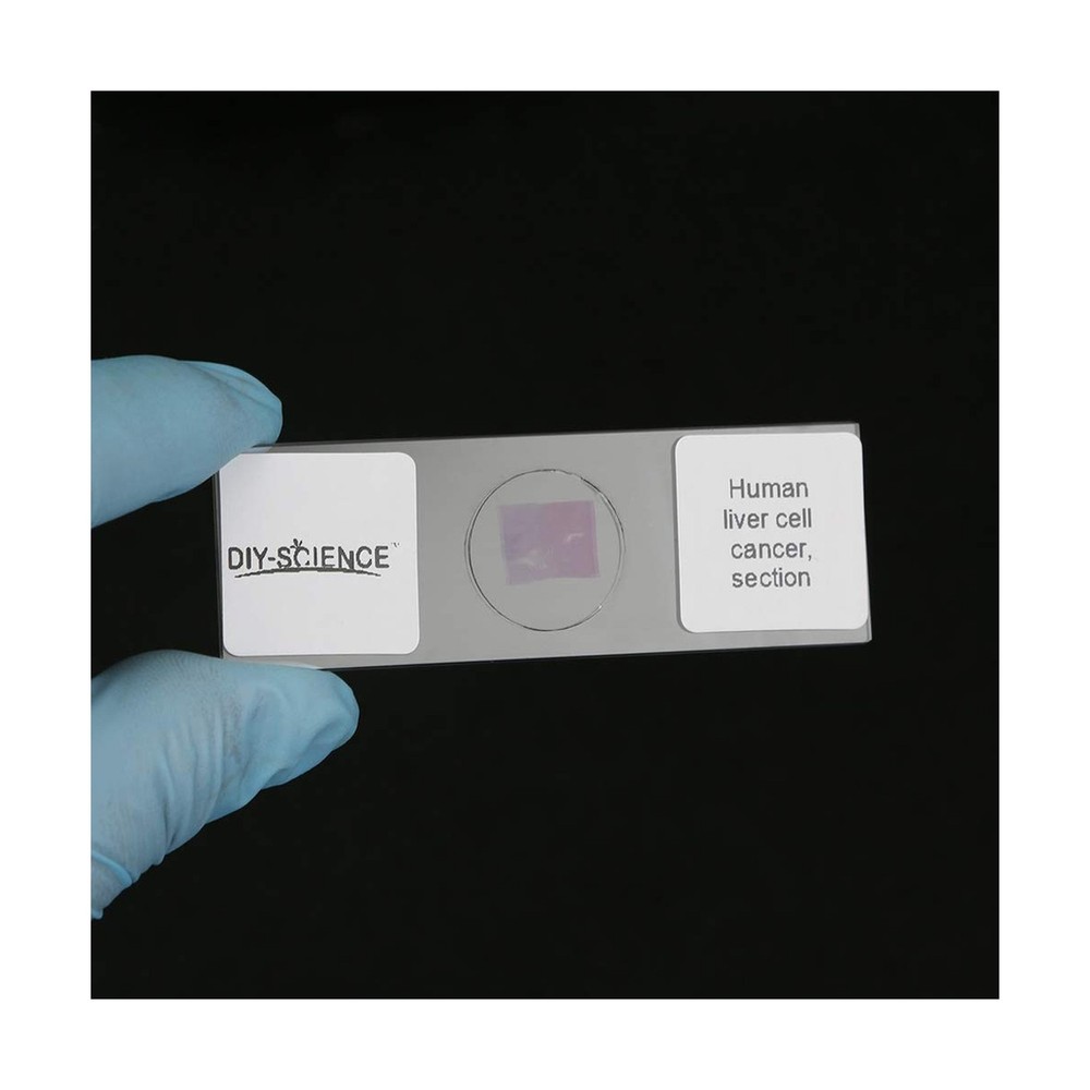 Prepared Human Pathology Microscope Slide Set, 12pcs Research-Quality Prepare...