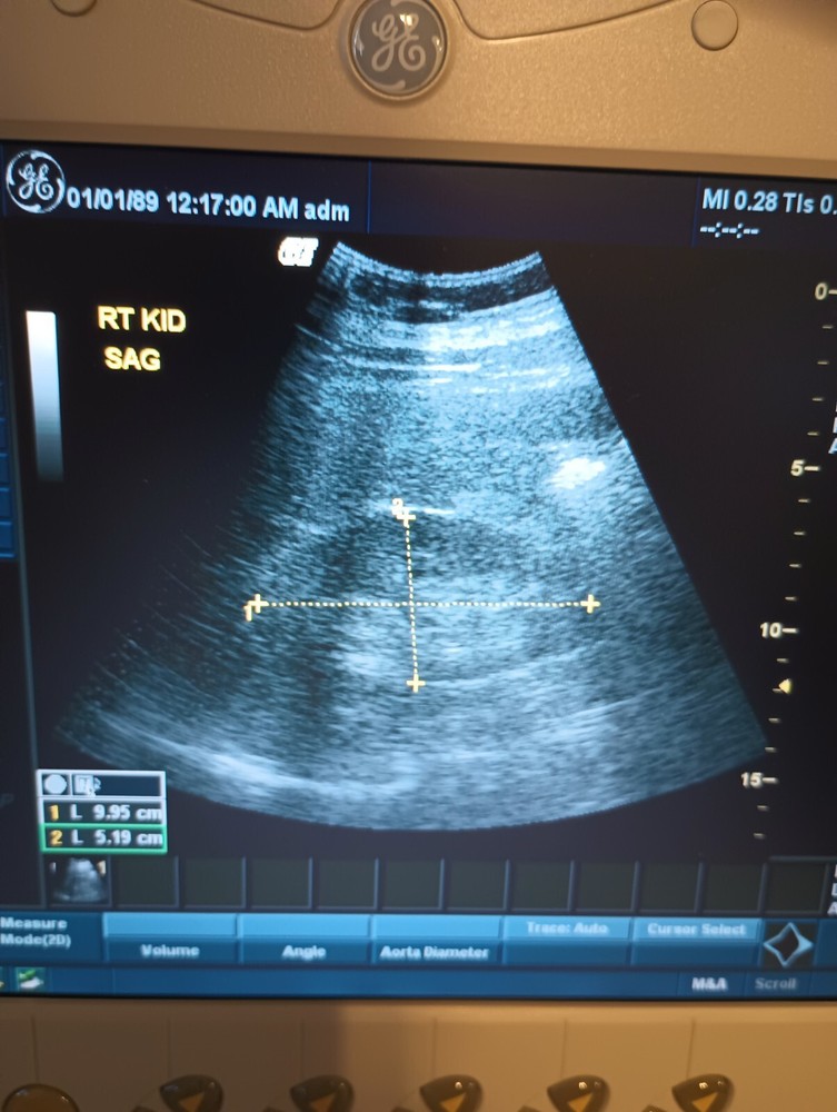 GE Logic Xp Ultrasound Machine