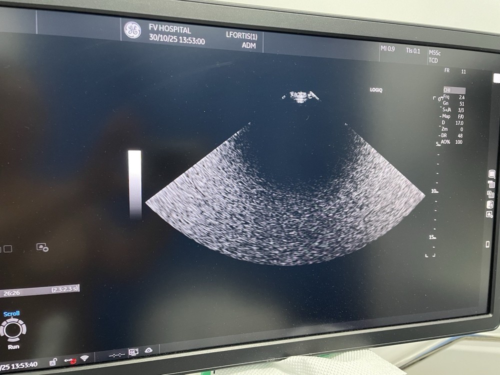 Ge ultrasound probe Phase Array M5SC-D