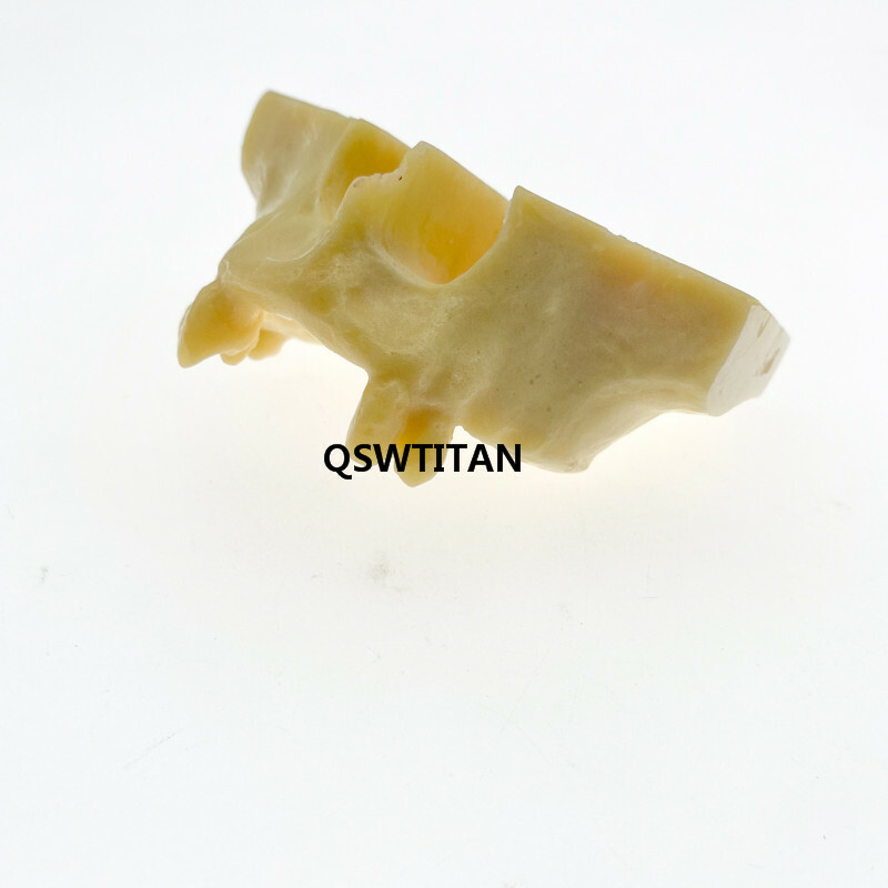 Dental Sinus Lift Practice Teeth Model Typodont Study Model 2013F