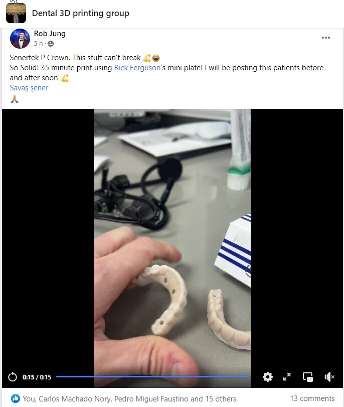 DLP SLA LCD 3d printer permenant crown - teeth resin ..