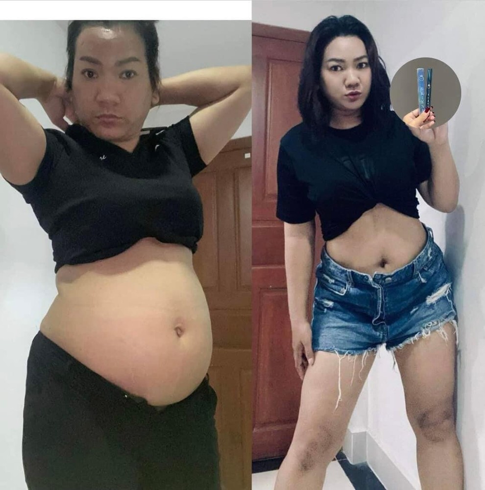SKINNY Fast Slimគ្រាប់សម្រកធម្មជាតិ ស្គីននី ( 1ប្រអប់/ 30គ្រាប់ )