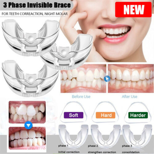 Invisible Dental Orthodontic Braces Teeth Corrector Alignment Trainer Retainer