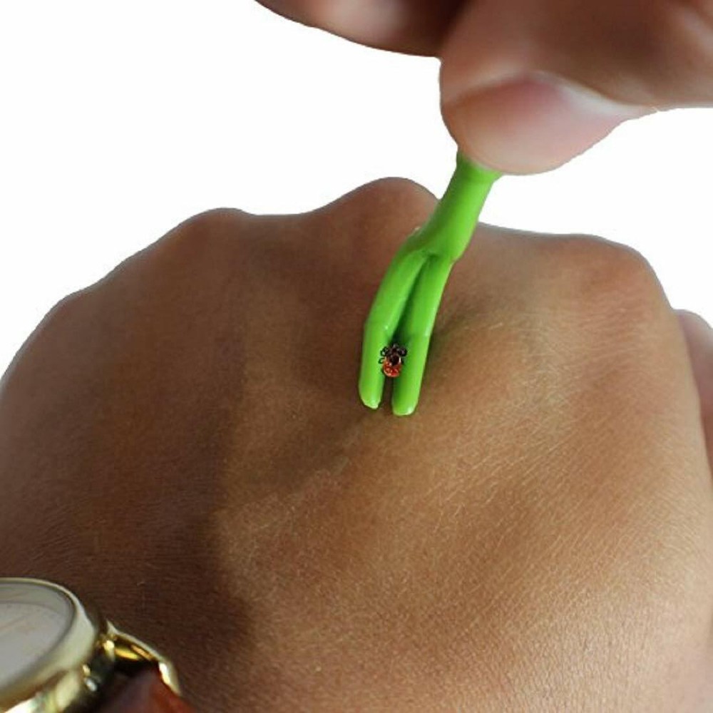 TickCheck Tick Remover Value 3 Pack - Tick Remover Tools
