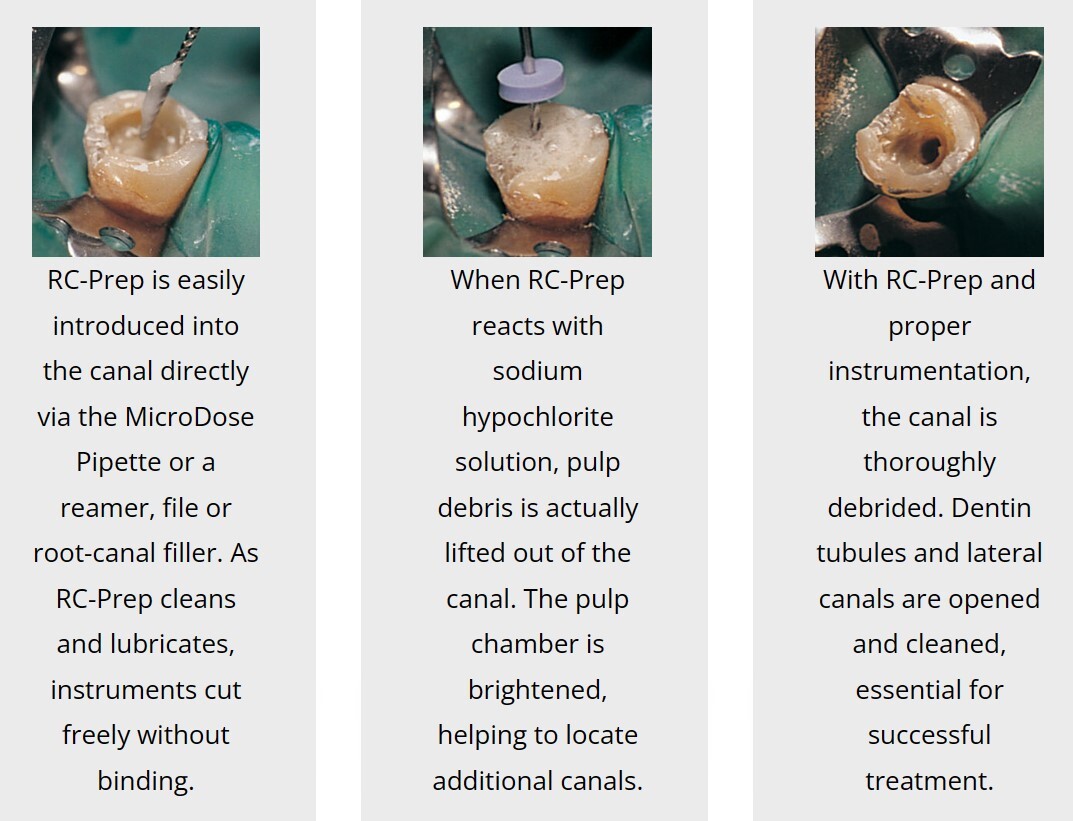 Premier RC-Prep Chemo-Mechanical Preparation of Root Canals, 18 Gm Jar, #9007131