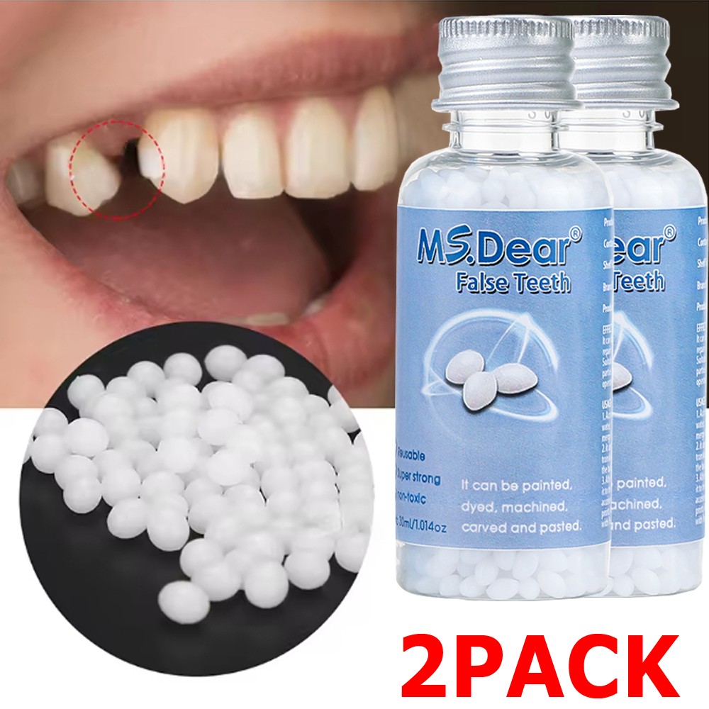 2X Tooth Repair Kit - Temporary Teeth Replacement Kit for Missing & Broken Teeth