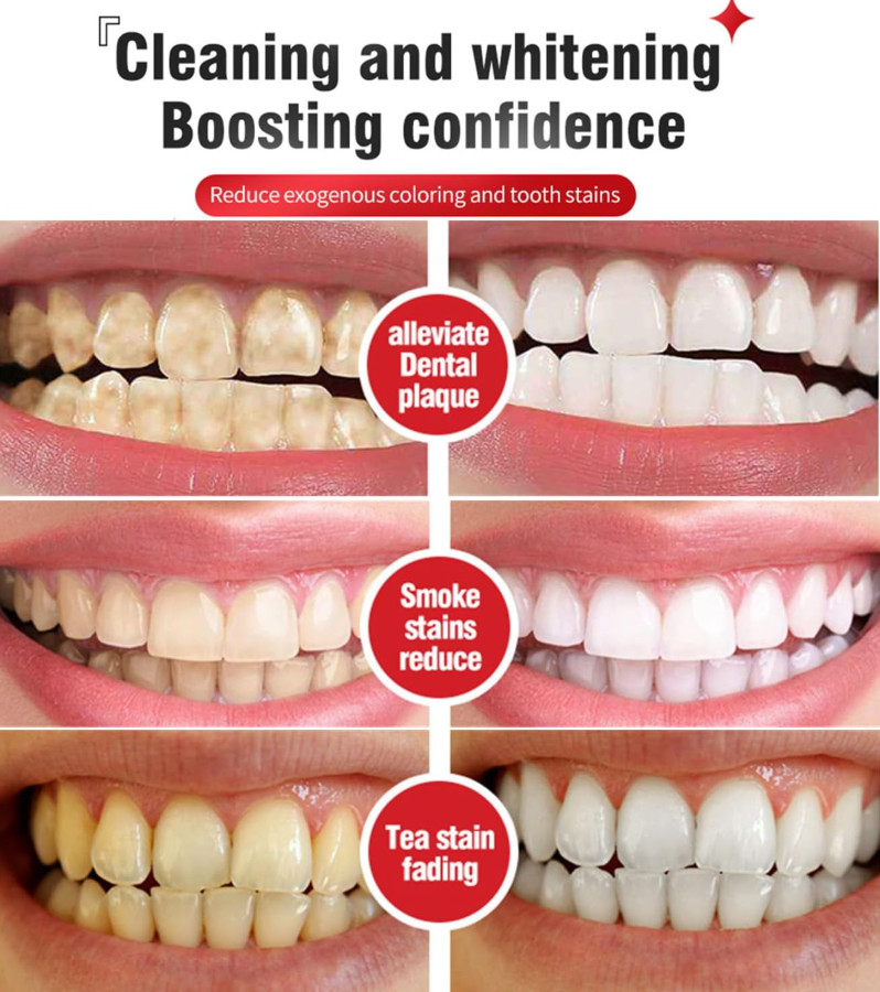 2 Pcs Super Probiotic SP-6 Toothpaste, Probiotics Bright White Toothpaste, Sp 6,