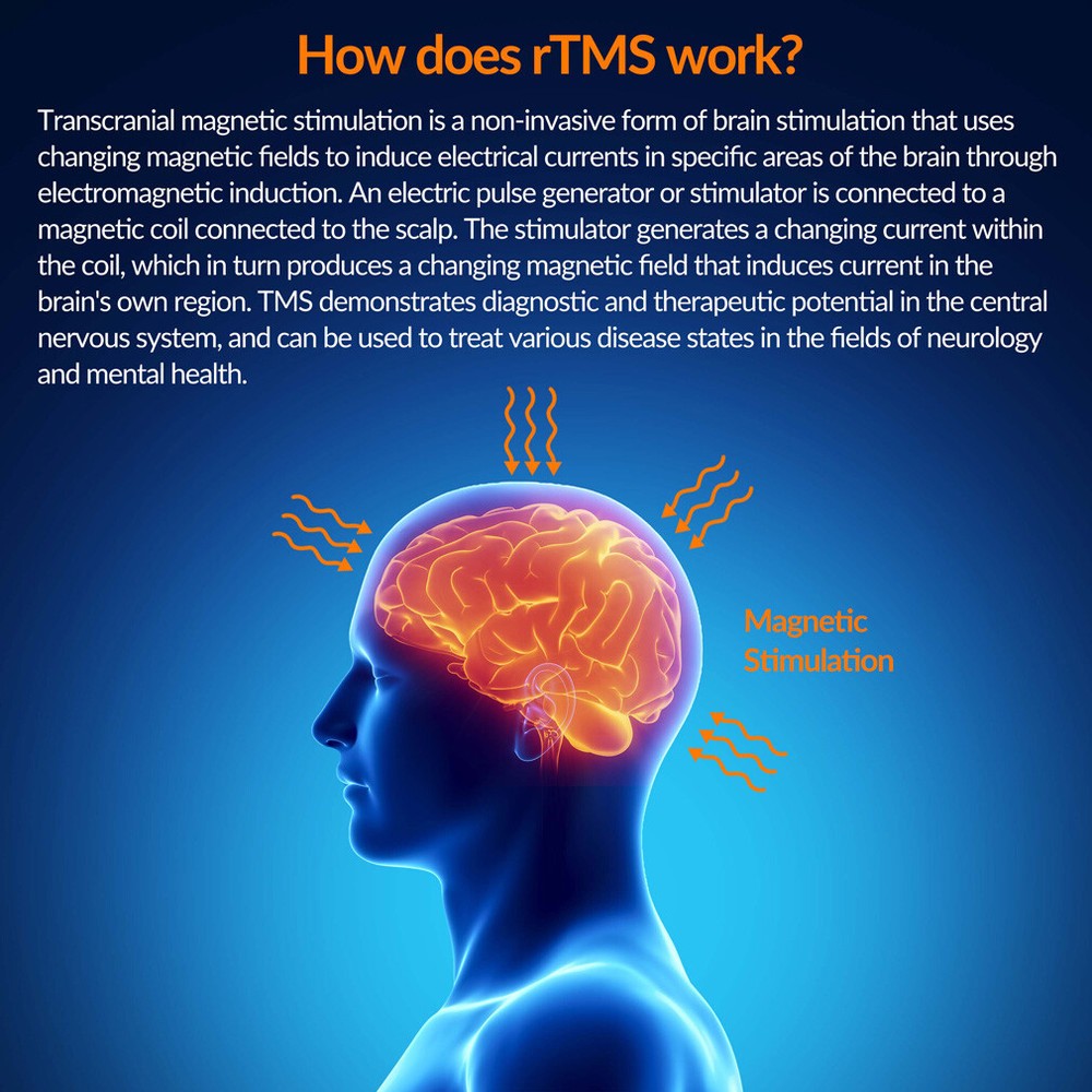 Transcranial Magnetic Stimulation rTMS Device for Brain Depression & OCD Therapy