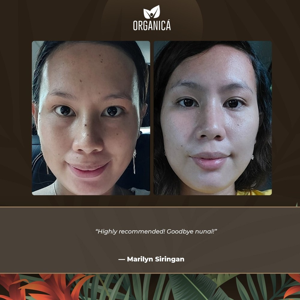 Multi-Awarded Mole and Warts Remover Set