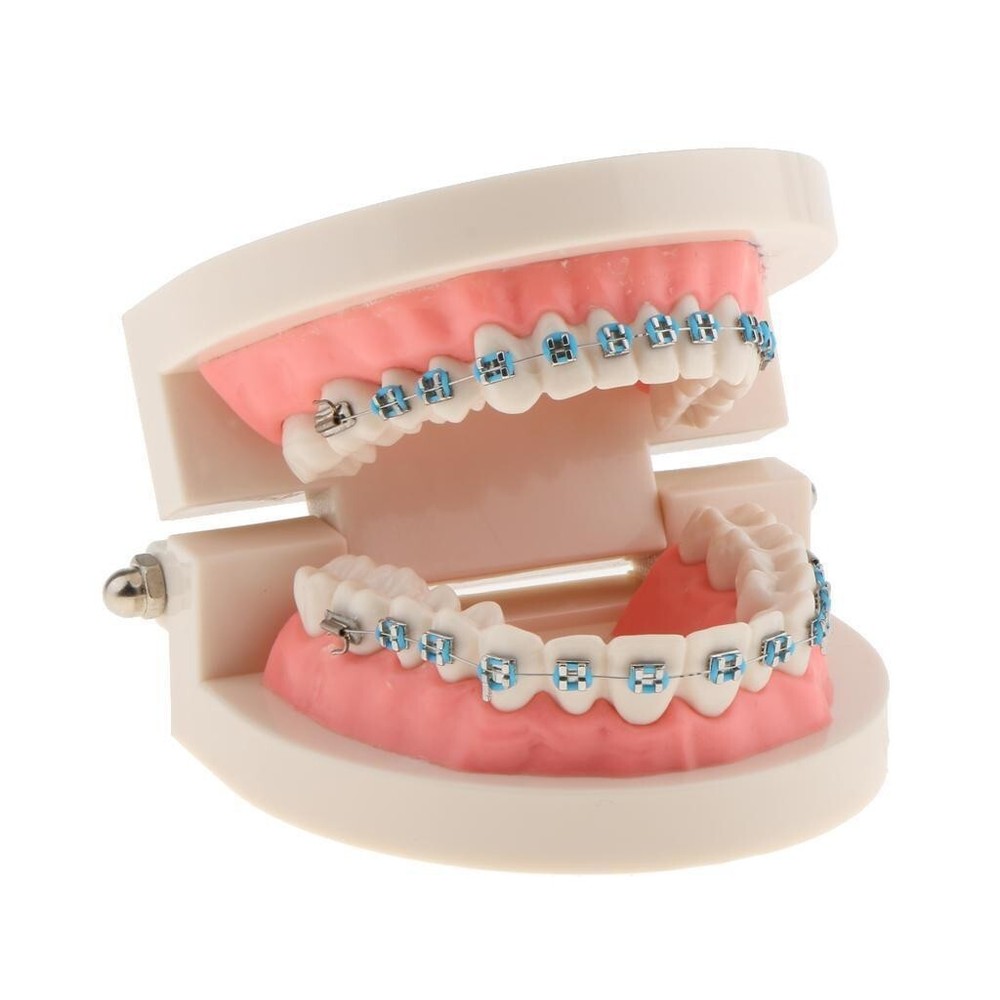 Dental Teach Typodont Demonstration Teeth Model with Braces For Patient Study