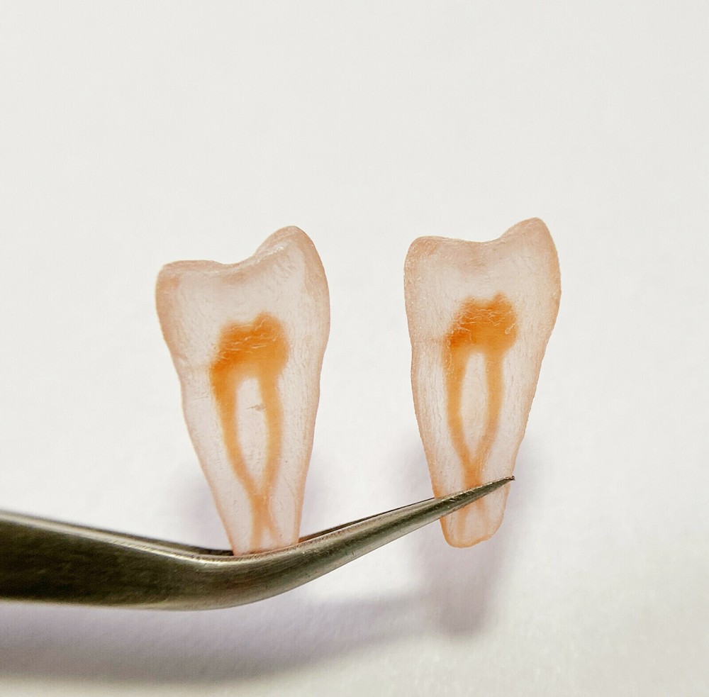 1Pcs Dental Dentist School Study Model Endodontic Practise 3D Teeth Replicas