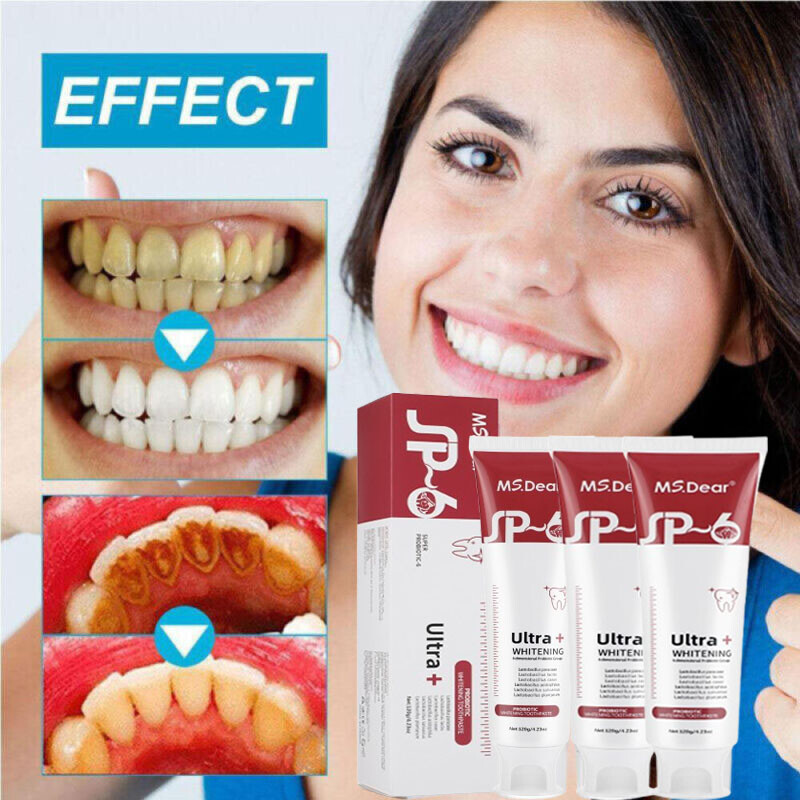 3PCS SP-6 Probiotic Toothpaste,Sp-6 Toothpaste Ultra Whitening Teeth Quick White