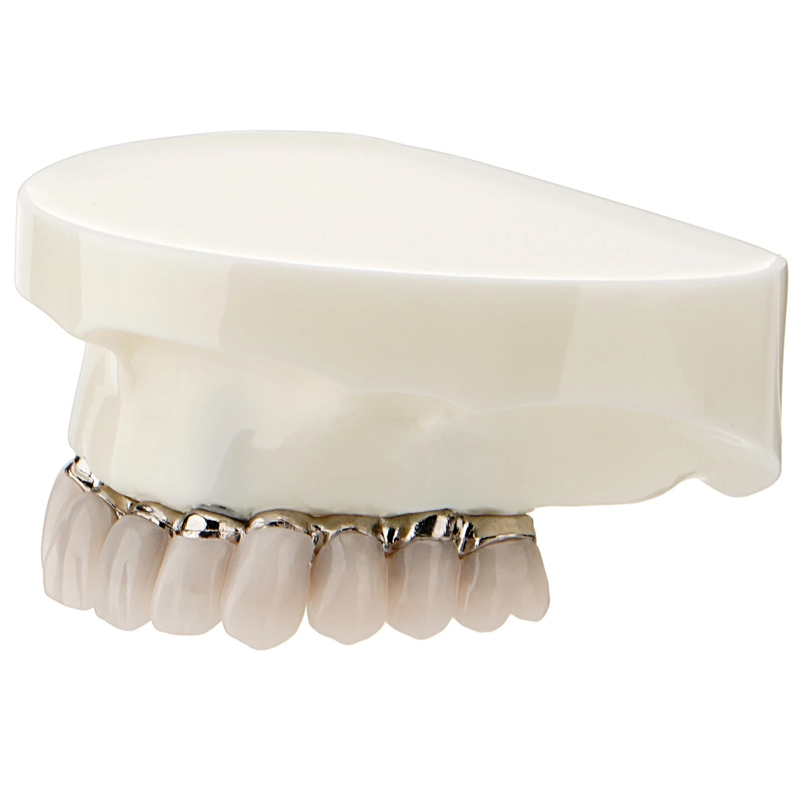 Dental All-on-4 Overdenture Model Dental Upper Jaw Implants Restoration 4 Screws