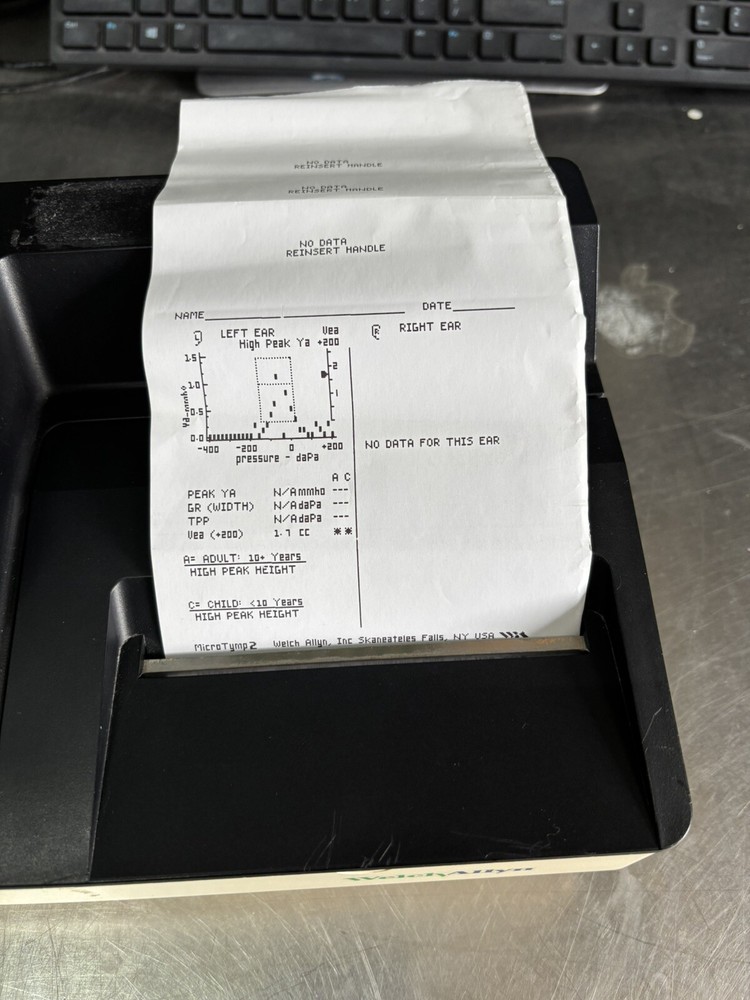 Welch Allyn Microtymp 2
