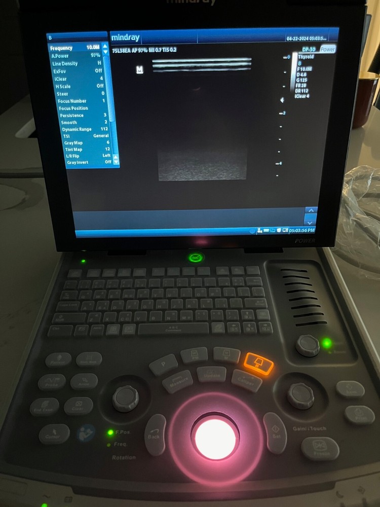 Mindray DP-30 Ultrasound System Model 2020