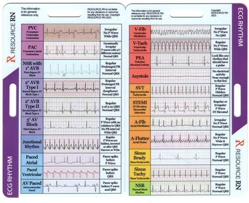 EKG Rhythm Interpretation - Compact & Portable Reference Card – Rapid
