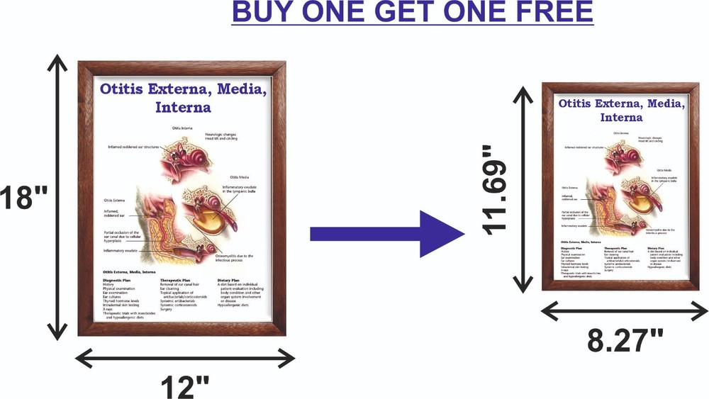 Otitis Externa, Media, Interna Chart 12x18 inches
