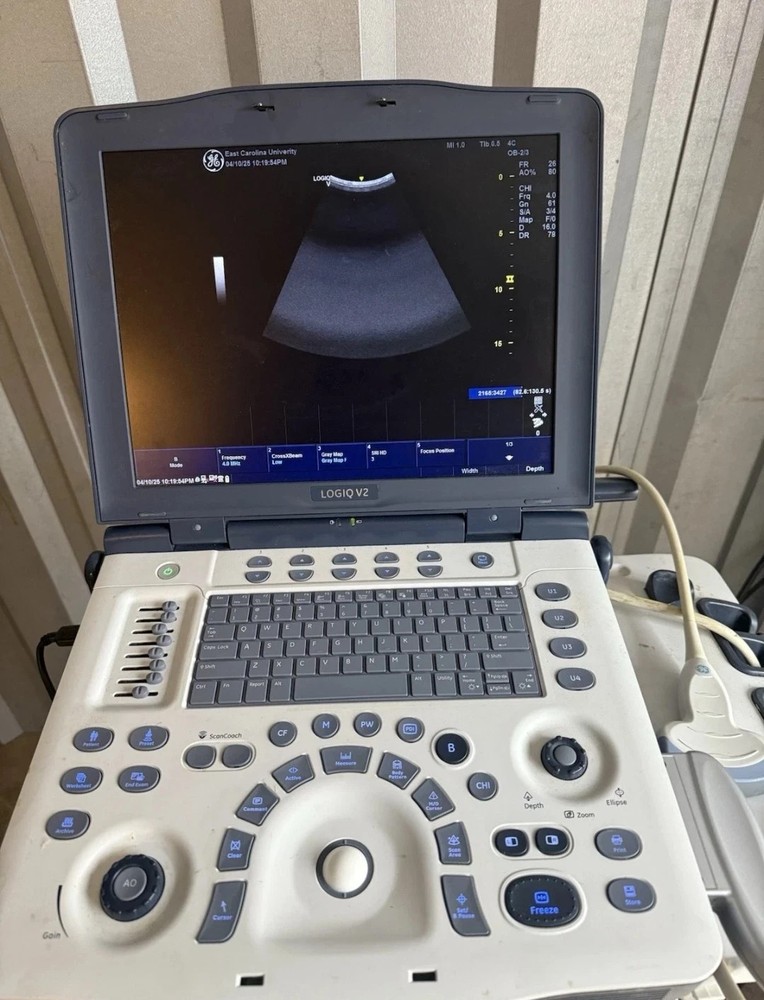 2017 GE LOGIQ V2 Portable Ultrasound With 4C-rs Probe
