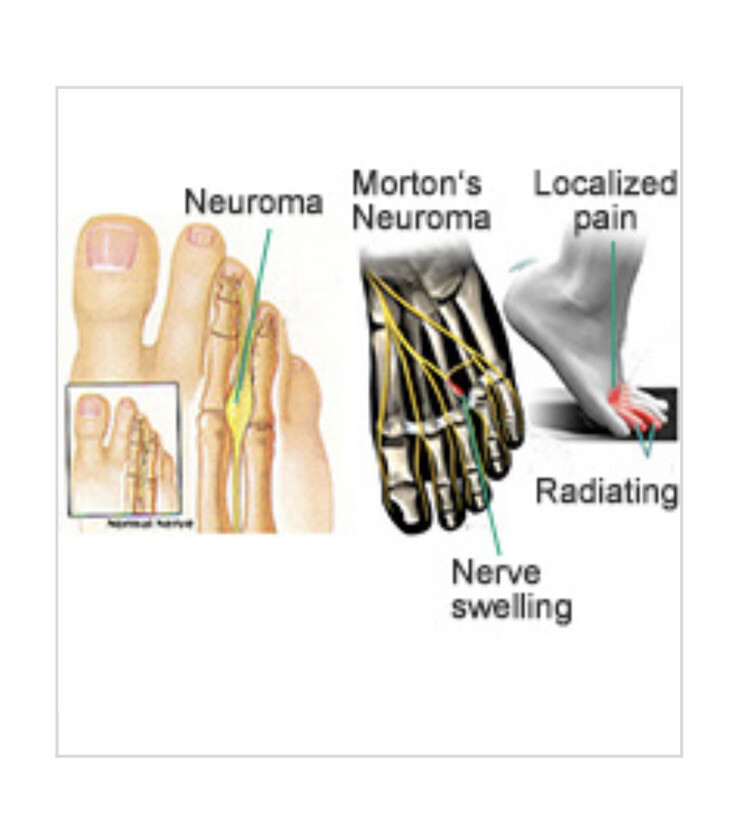 1x dental laser Diode soft tissue laser