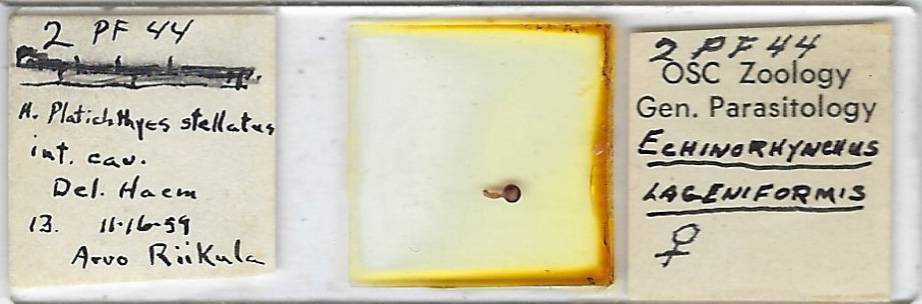 Echinorhynchus lageniformis w.m. from Flatfish Microscope Slide
