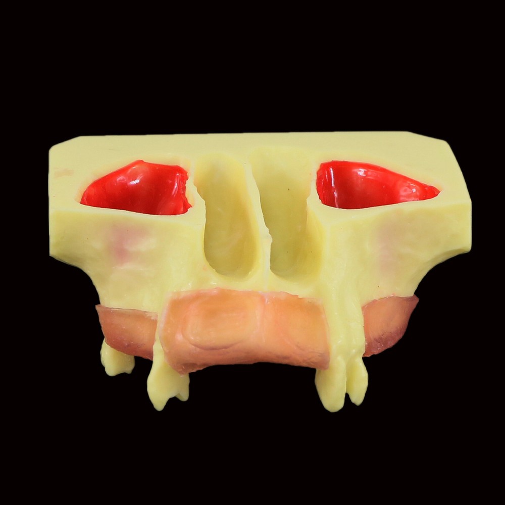 Dental Typodont Teeth Model Sinus Lift Practice Study Teach Demo Model 2012 2013
