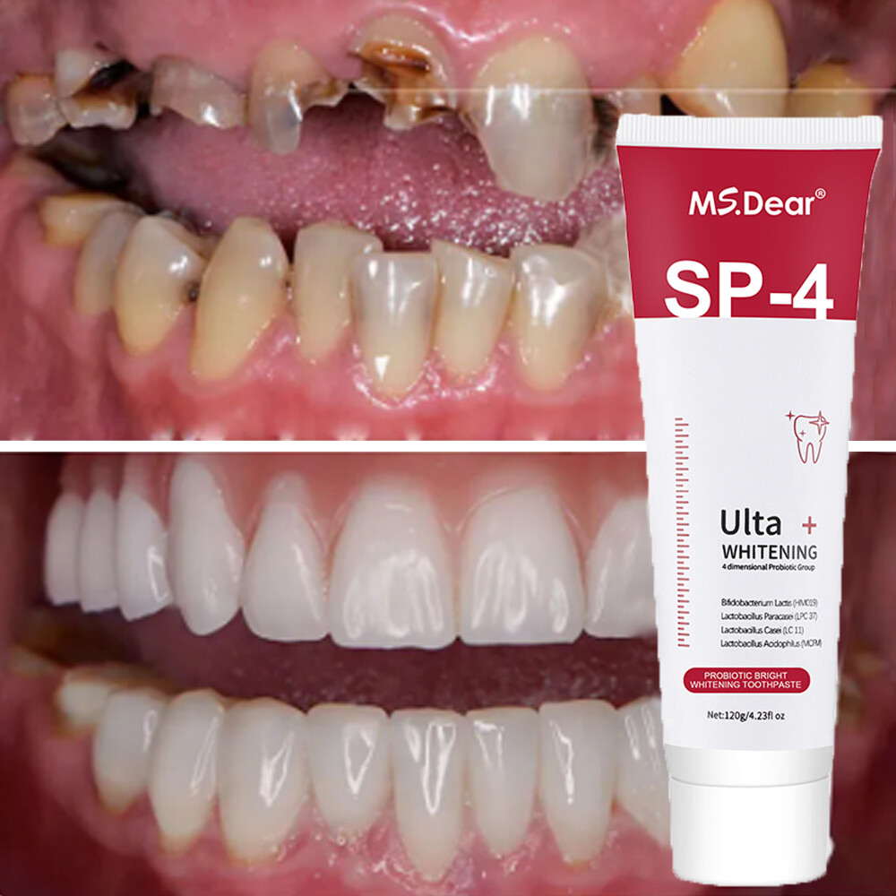 Sip-4 Toothpaste, Whitening Sp-4 Toothpaste, Sp-4 Probiotic Whitening Toothpaste