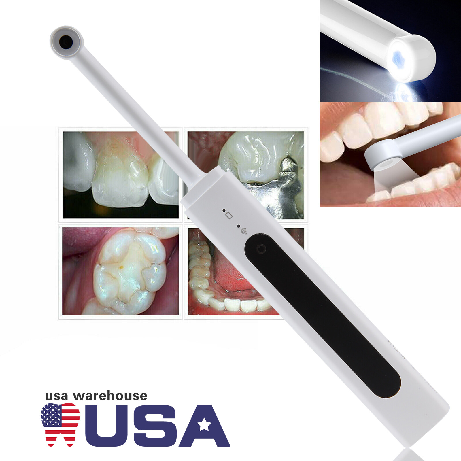 Dental USB Intraoral Camera Oral Endoscope Digital Imaging Intra Oral images