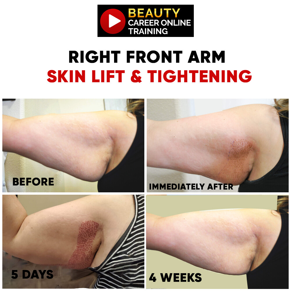 Beauty Career Wrinkle Reducing Complete Online Training Certification Course