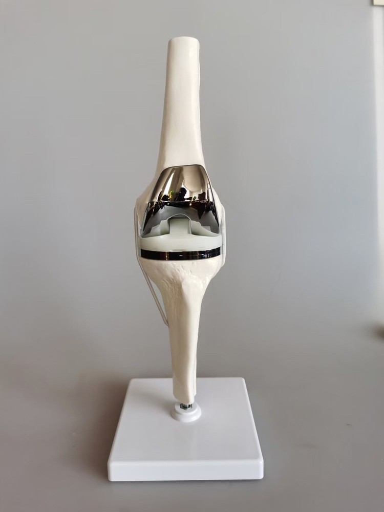 Detachable Knee Prosthesis Medical Anatomical Teaching Display Model Display
