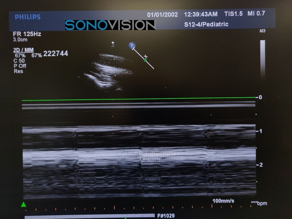 Philips S12-4 (Explora) - 453561270611