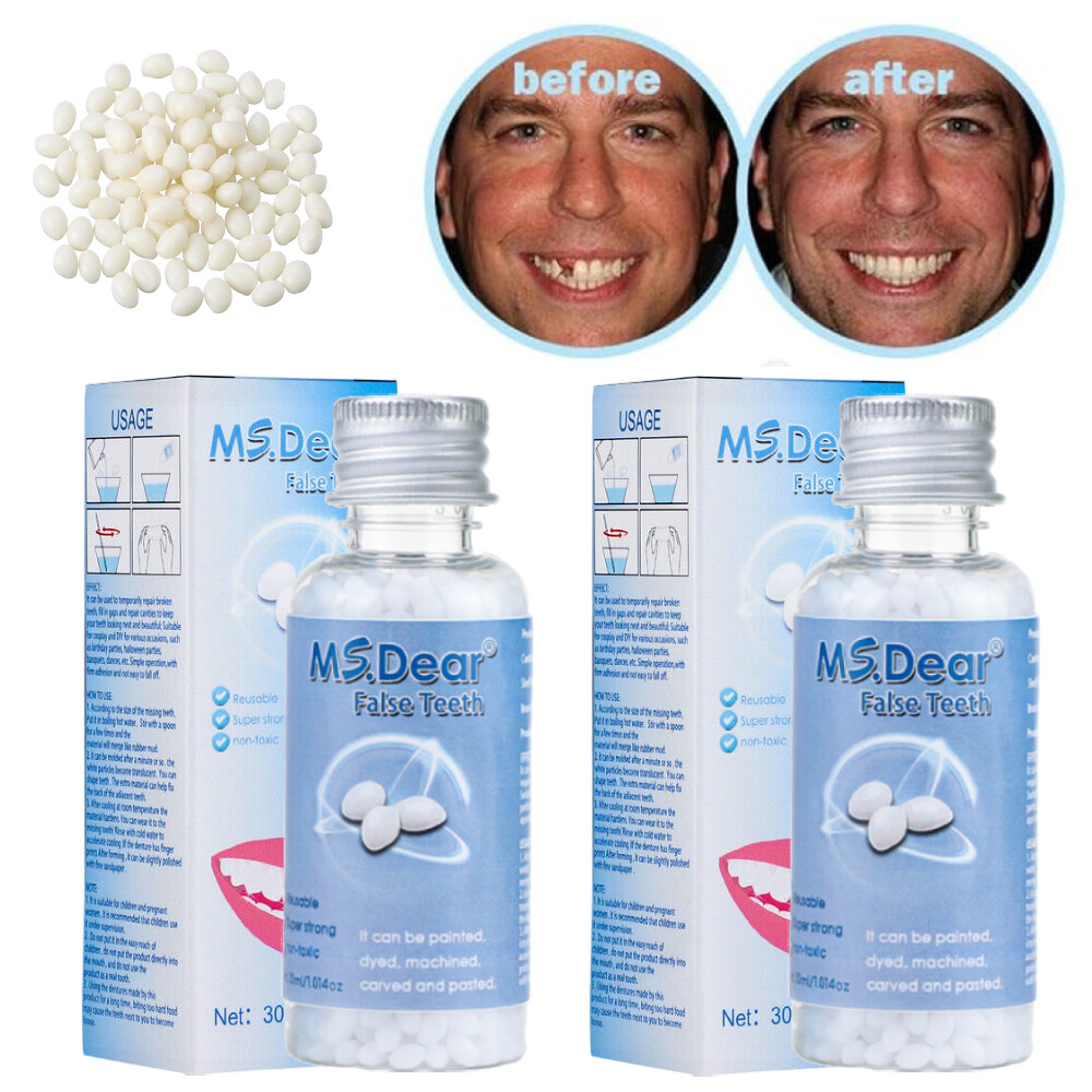 5 x Tooth Repair Granules Temporary Fitting Beads Reusable Moldable False Teeth